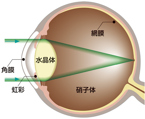 透明な水晶体では